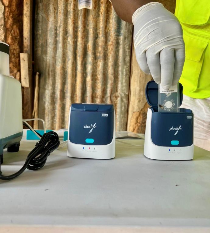 Image de l'article Tuberculose : une avancée dans le diagnostic