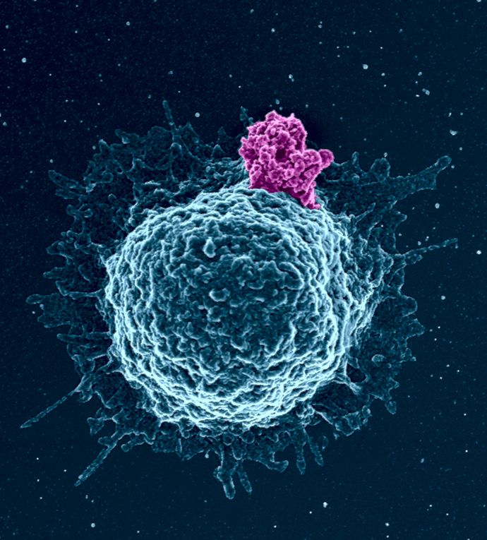 Image de l'article Un mooc pour tout savoir sur la science du VIH