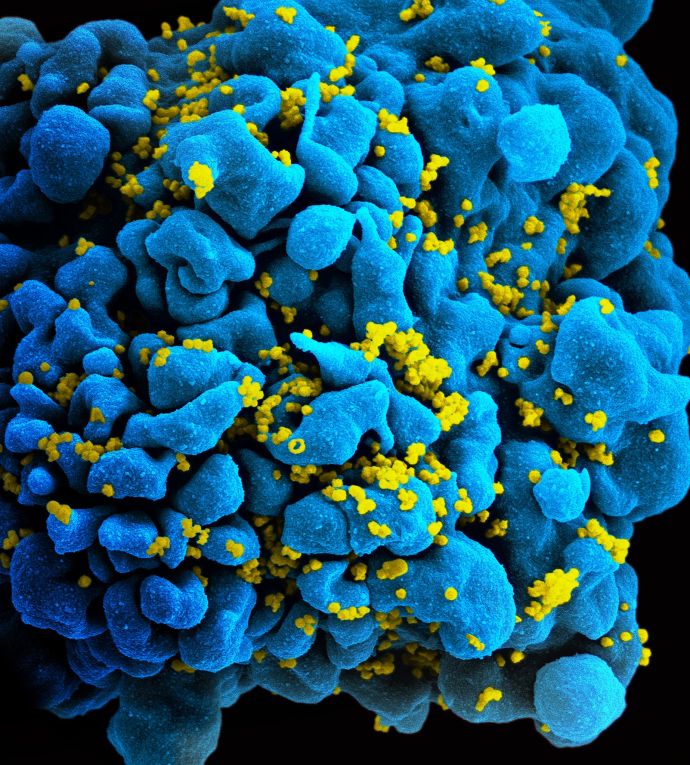 Image de l'article Guérison
ou rémission du VIH : de quoi parle-t-on ?